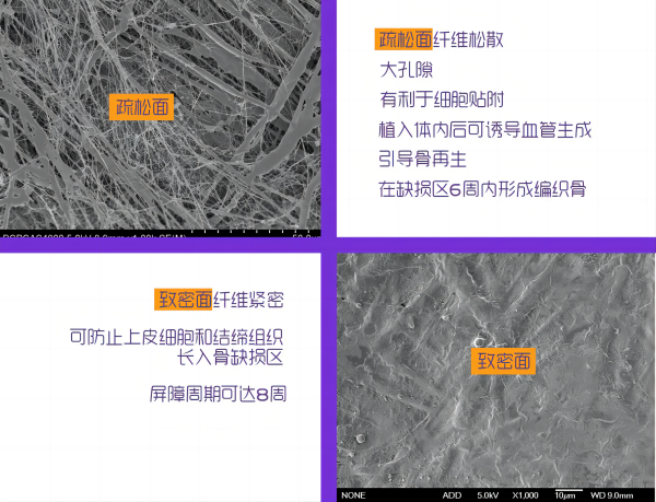 4-电镜图(1).png