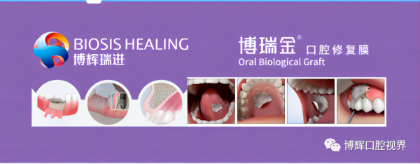 5-产品应用动画示意(1).png